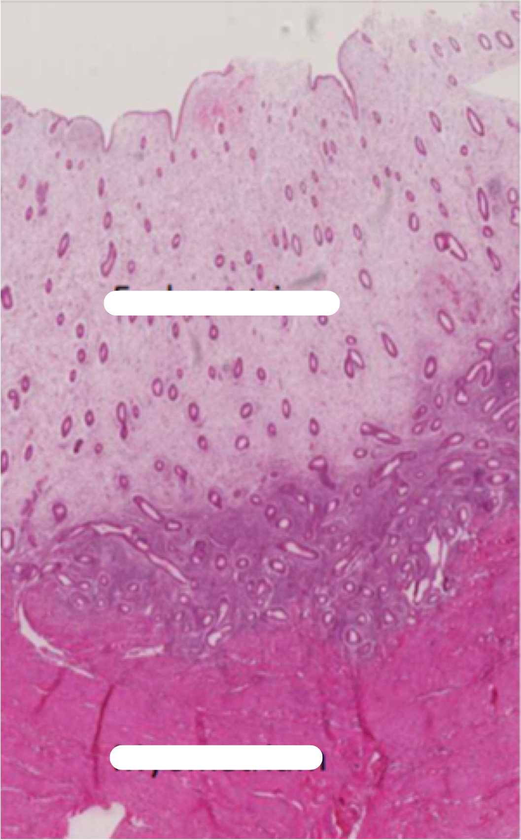 <p><span>Identify the following histology:</span></p>