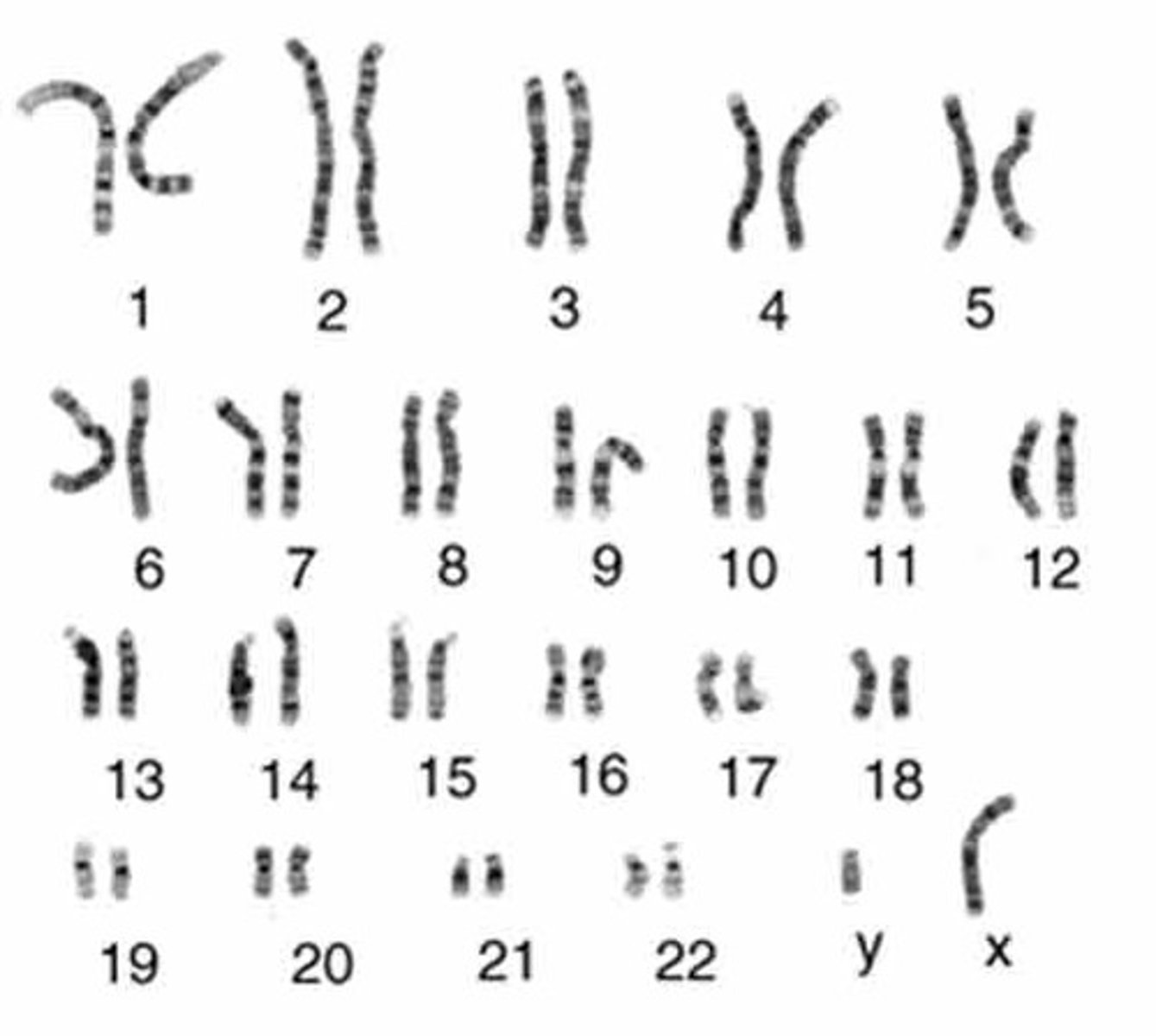 <p>A display of the chromosome pairs of a cell arranged by size and shape.</p>