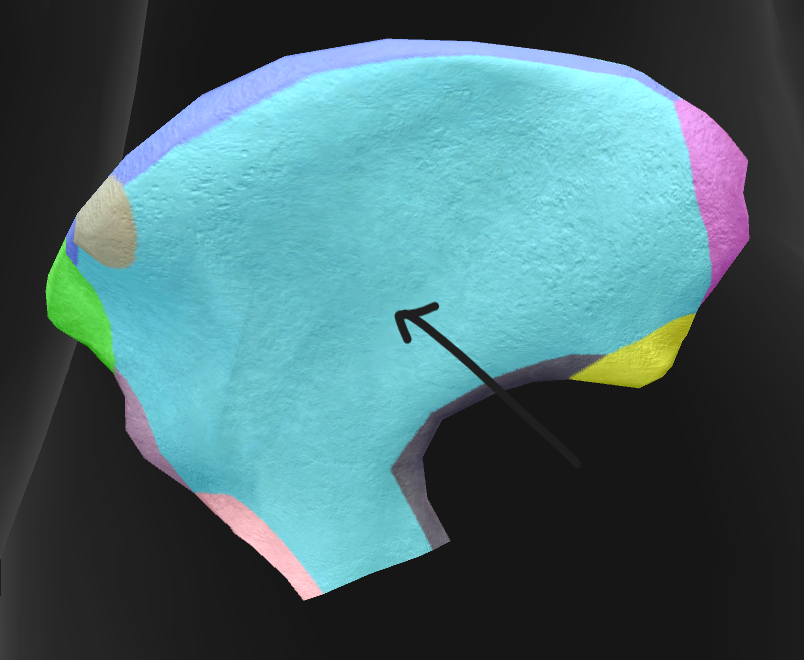 term image