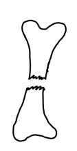 <p><span>what type of fracture/bone position is this?</span></p>