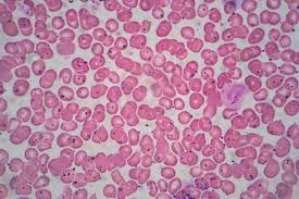 <p>A type of specialized connective tissue that circulates throughout the body, consisting of red and white blood cells suspended in plasma, and is crucial for transportation of nutrients, gases, and waste. </p>