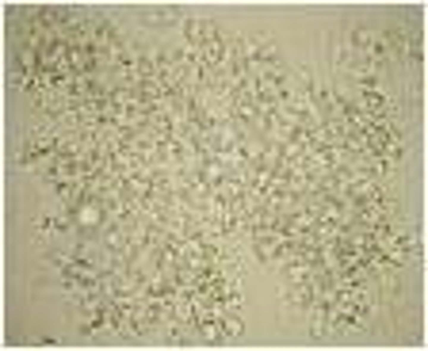 <p>- Alkaline/Neutral pH &lt;8.0</p><p>- White to colorless</p><p>- They appear as granules and when they are in large quantities, after refrigeration they form a white precipitate that does not dissolve upon warming.</p>