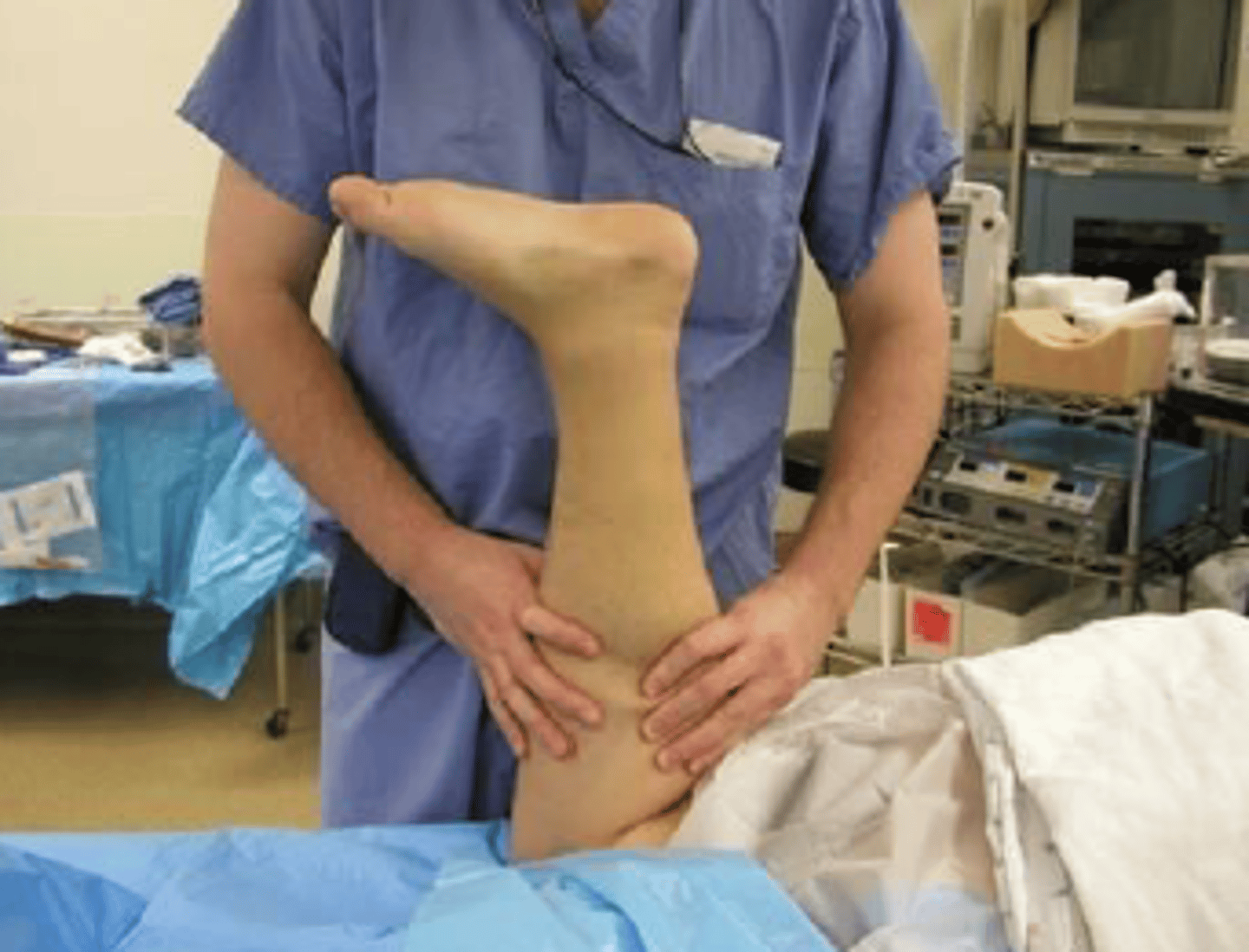 <p>C. Achilles tendon rupture</p>