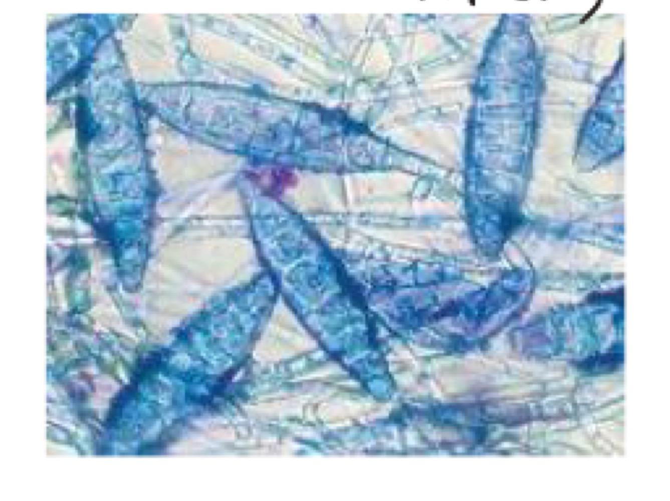 Identify this parasite.