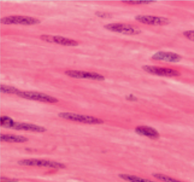 <p>Where is this muscle likely to be found?</p>