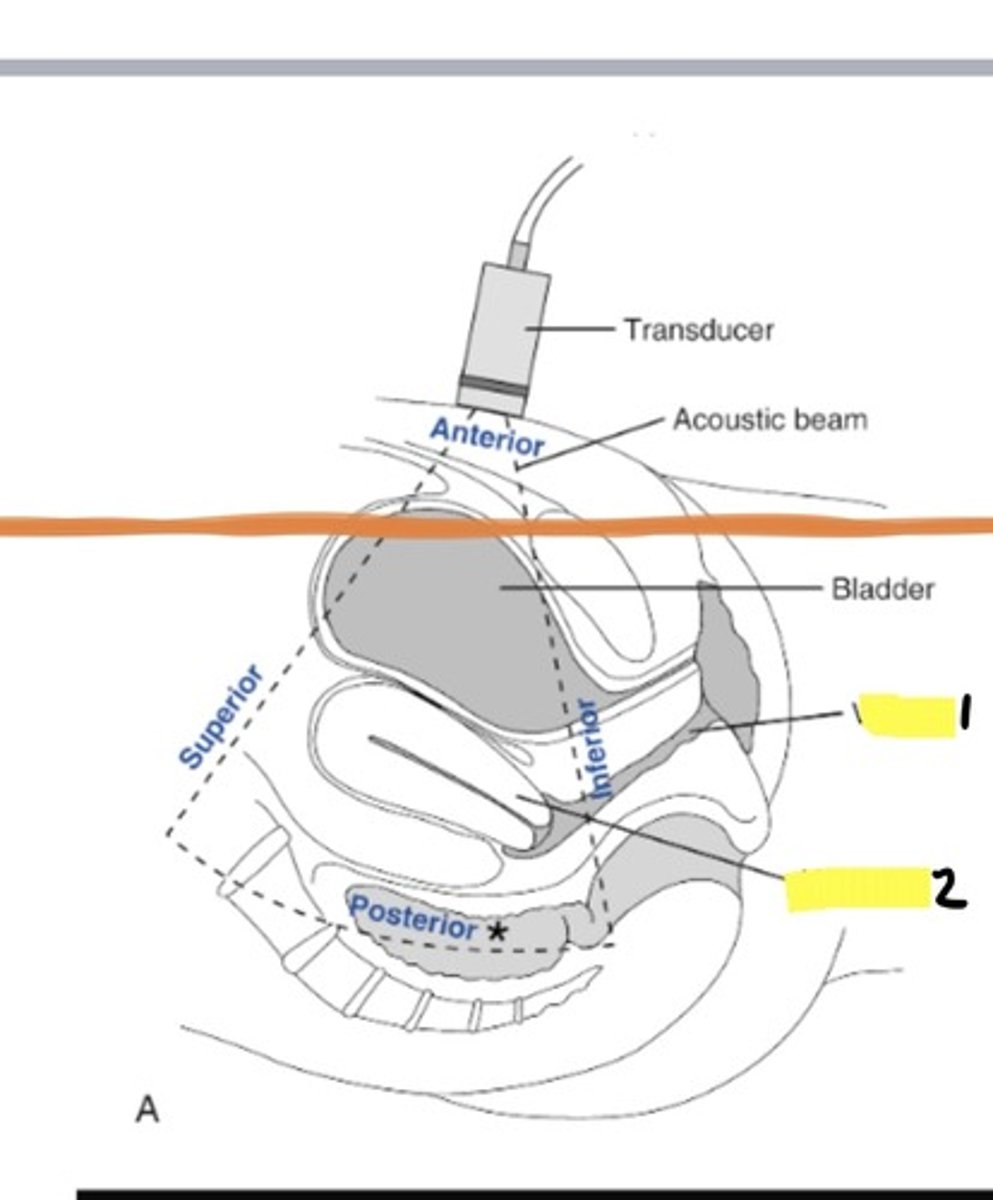 <p>1</p>