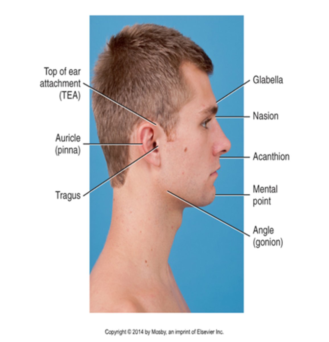 <p>TEA (top of ear attachment)</p>