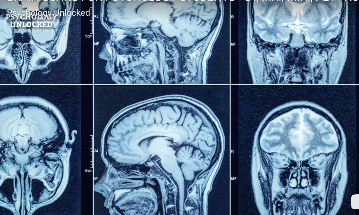 <p><strong>Structural brain scan</strong> (displays structure) which operates by running a magnetic field over one’s head; the hydrogen molecules in the brain respond by sending a wave in response. These waves are recorded via a scanner and display a snapshot of the brain, displaying a full picture of the brain’s anatomy.</p>