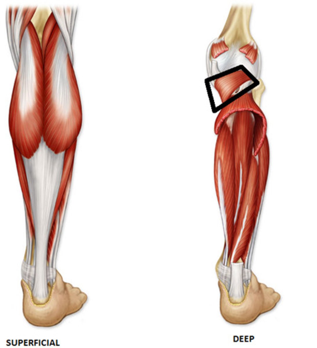 <p>Origin: lateral surface of lateral condyle of femur and lateral meniscus (intra-articular; within cavity of knee joint)</p><p>Insertion: posterior surface of tibia, superior to soleal line</p><p>Innervation: tibial nerve (L4, L4, S1)</p><p>Action: weakly flexes knee and unlocks it by laterally rotating femur on fixed tibia, may also medially rotate tibia of unplanted limb (“key to the knee”)</p>