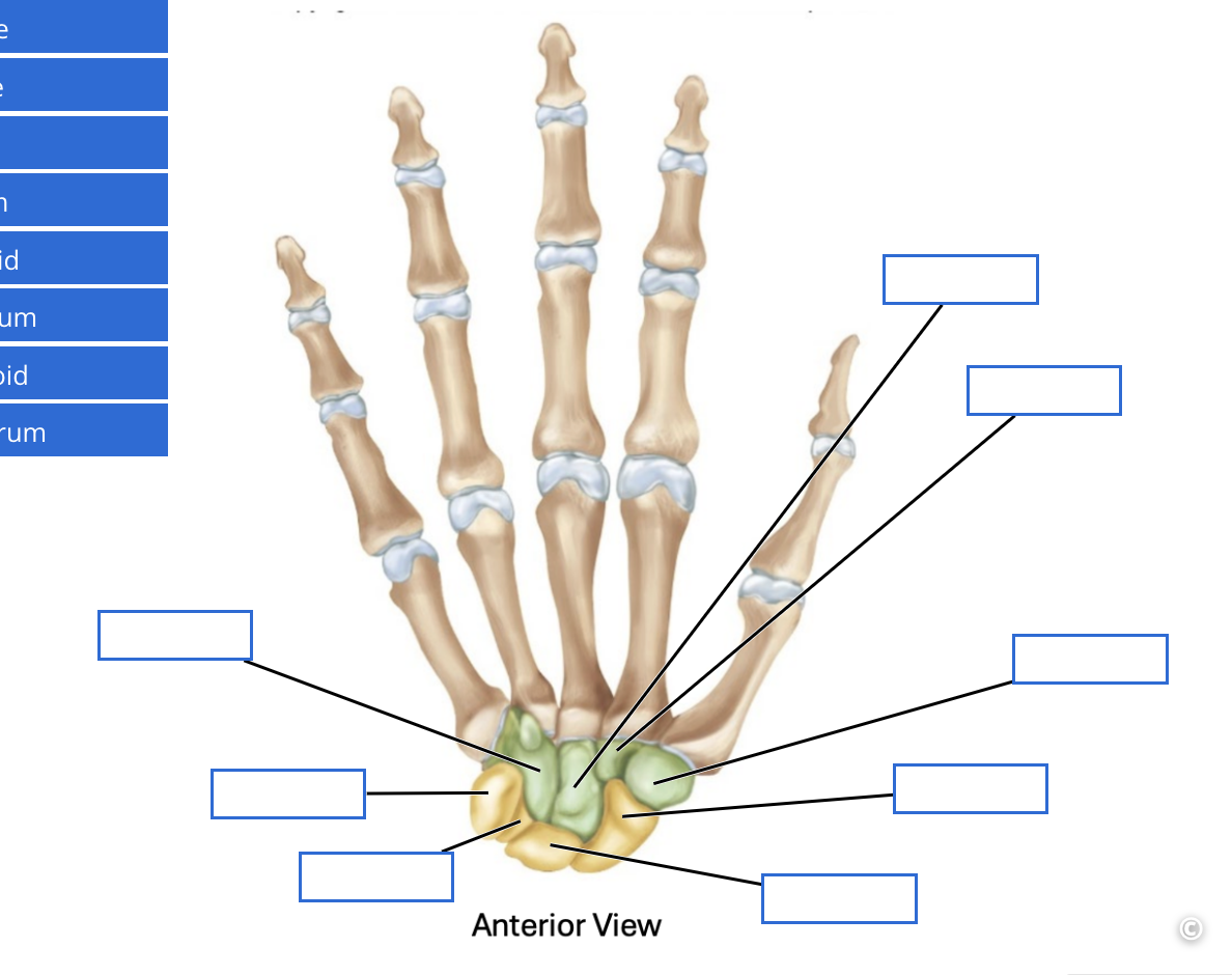 <p>Identify the carpal bones</p>