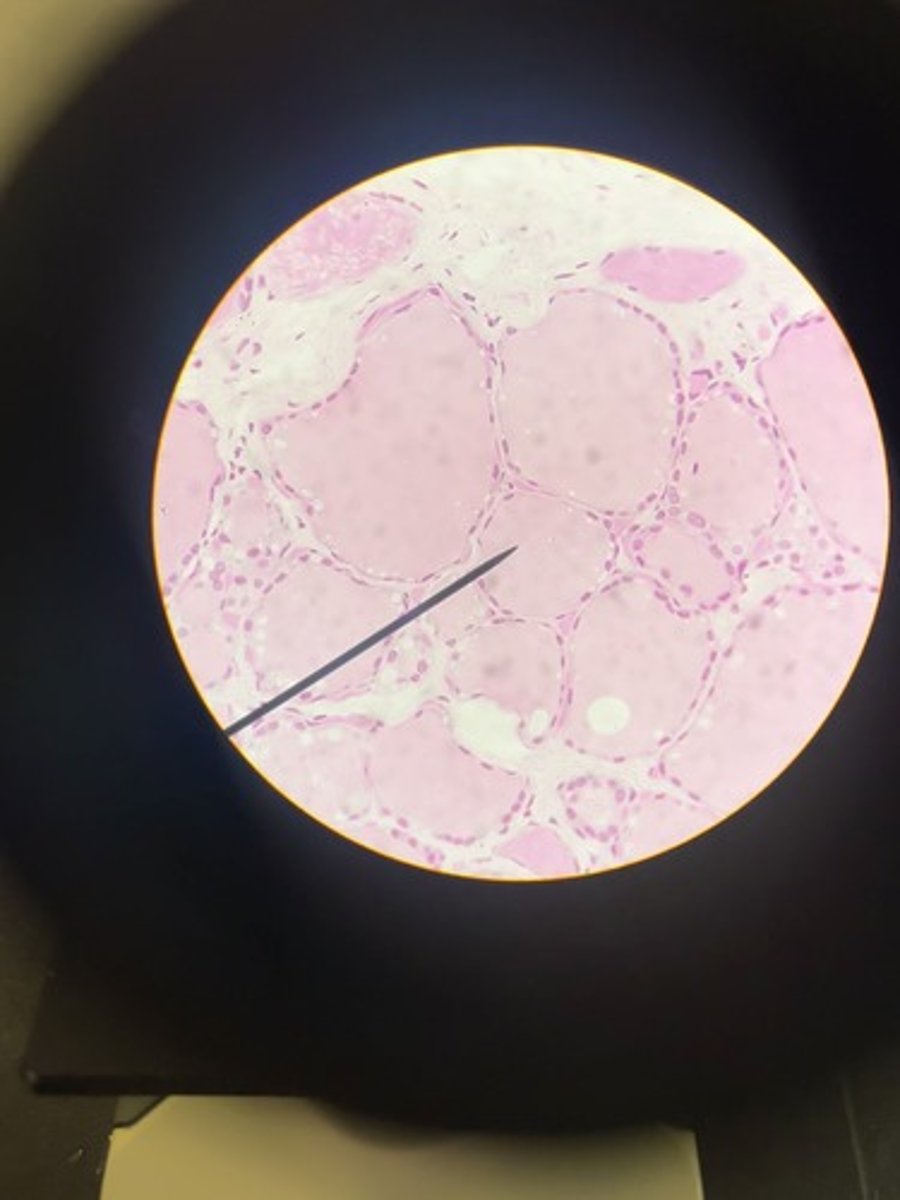 <p>- follicular cells &amp; c-cells</p><p>- thyroglobin, T3/T4 , calcitonin</p>