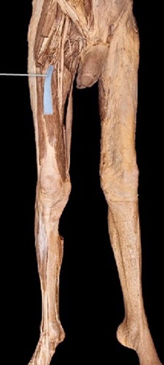 <p>What muscle is this?</p>