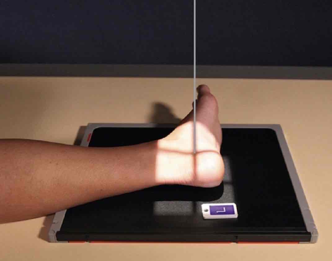 <p>What Projection is this?</p>