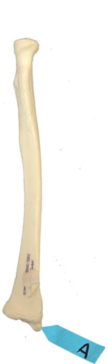 <p>Identify this bone marking.</p>