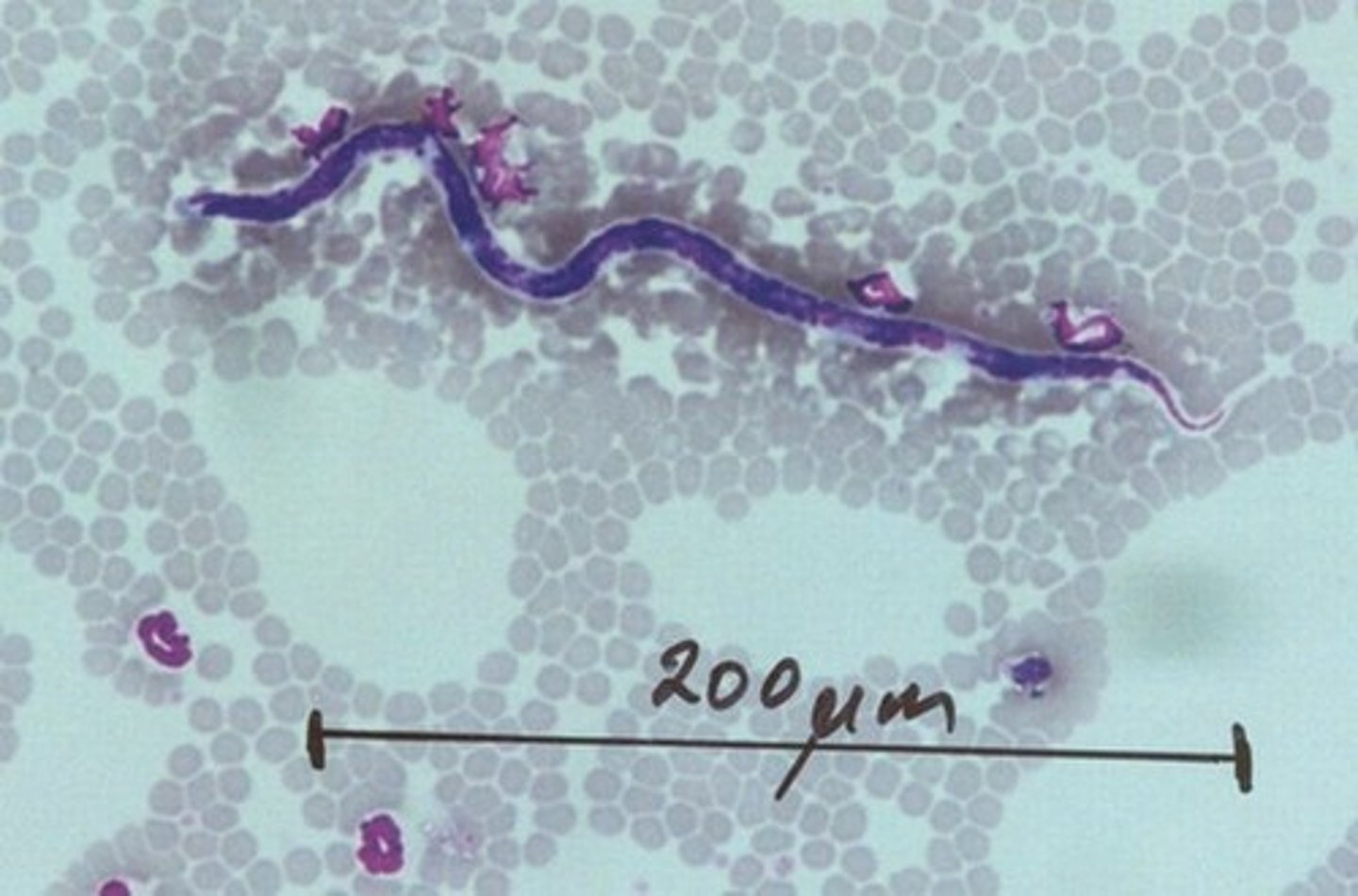 <p>symptoms can include coughing, exercise intolerance, and heart failure. it is diagnosed by checking for microfilariae in the blood smear. it is most easily detected by blood analysis checking for the heartworm antibody. (heartworm snap test) heart worms can take up to 6 months once infected to come out in tests. this is controlled by mosquito preventative medication and mosquito control. actual infestations are treated with microfilaricide and adulticide.</p>