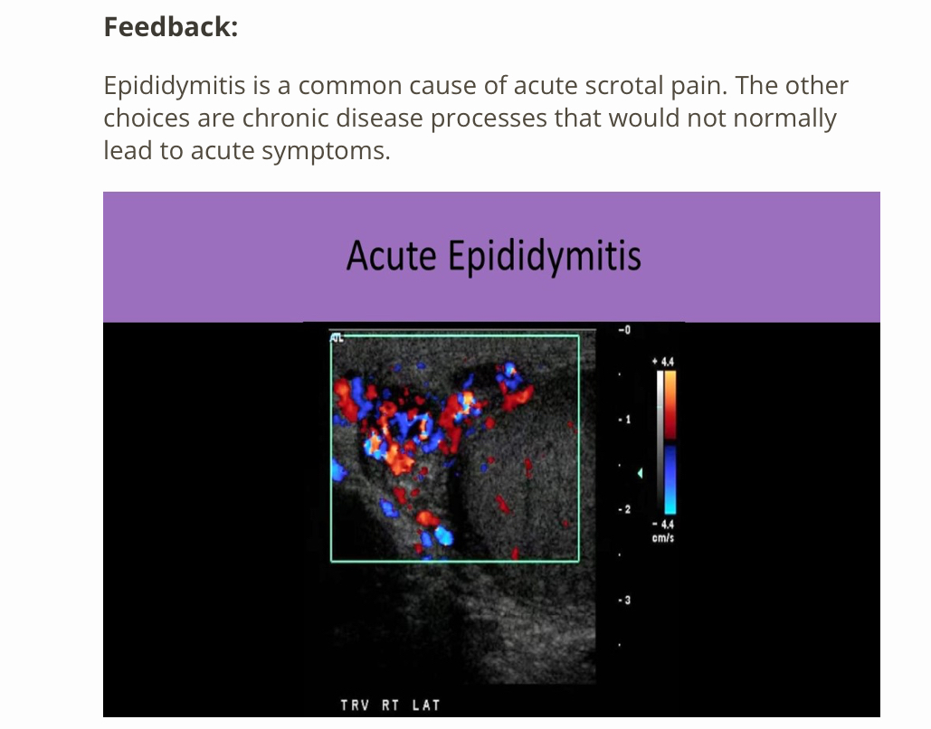 <p>A) epididymitis </p>