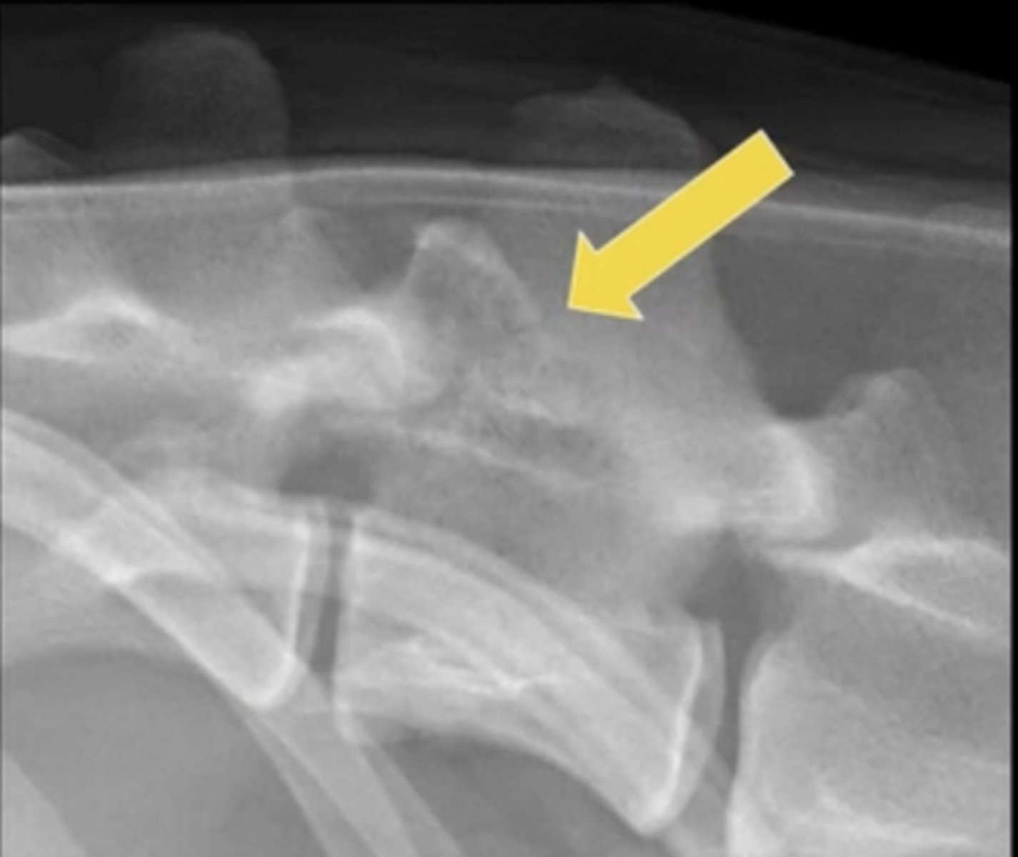 <p>Which pattern of destruction is this?</p>