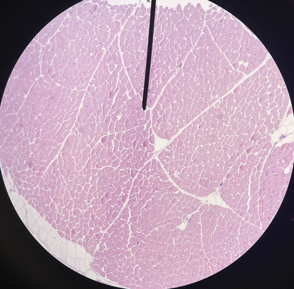 <p>What cross section is this?</p>