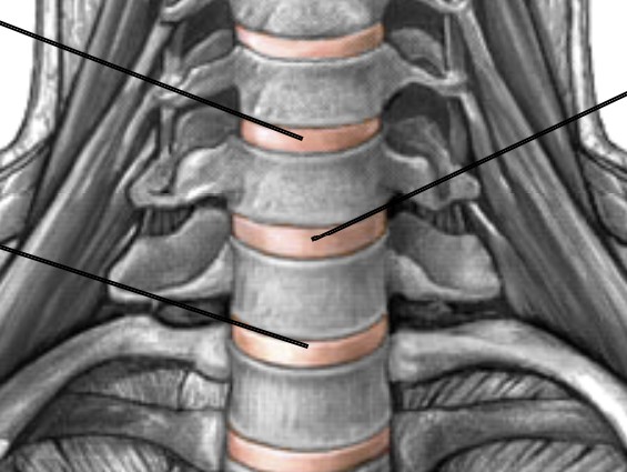<p>What are in between vertebral bodies?</p>