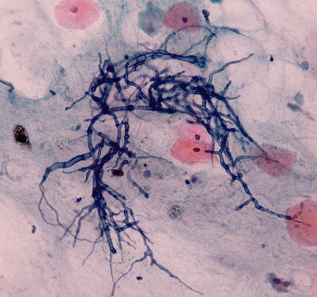 <p>pseudohyphae and budding</p>