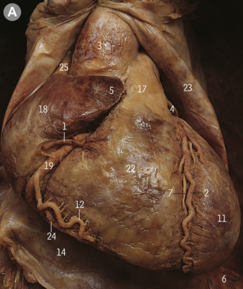 <p>What is 23?</p>