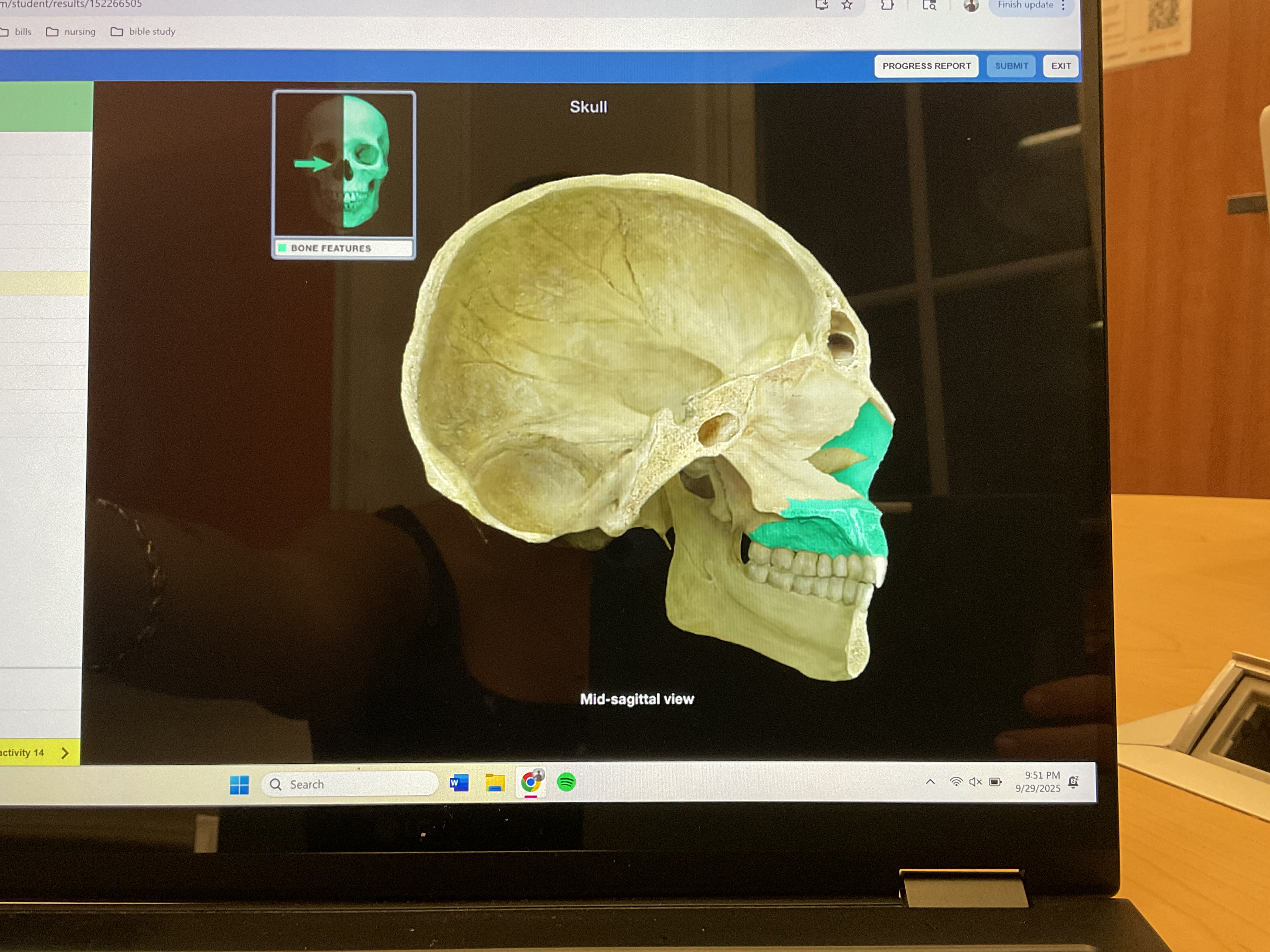 <p>Maxilla </p>