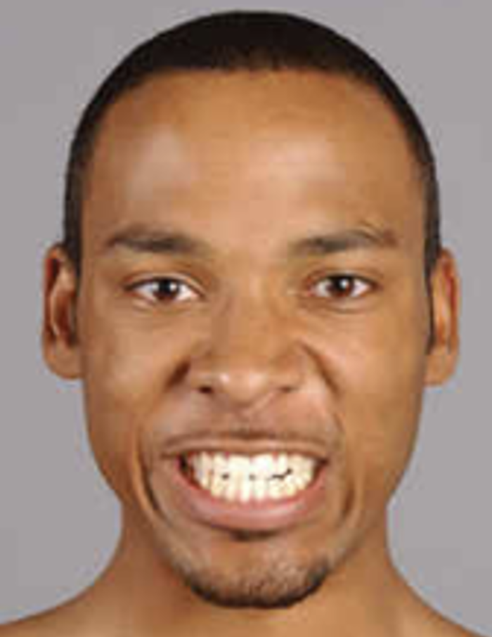 <p>are a group of muscles that work together to modify the size and shape of the mouth opening, facilitating various facial expressions. </p>