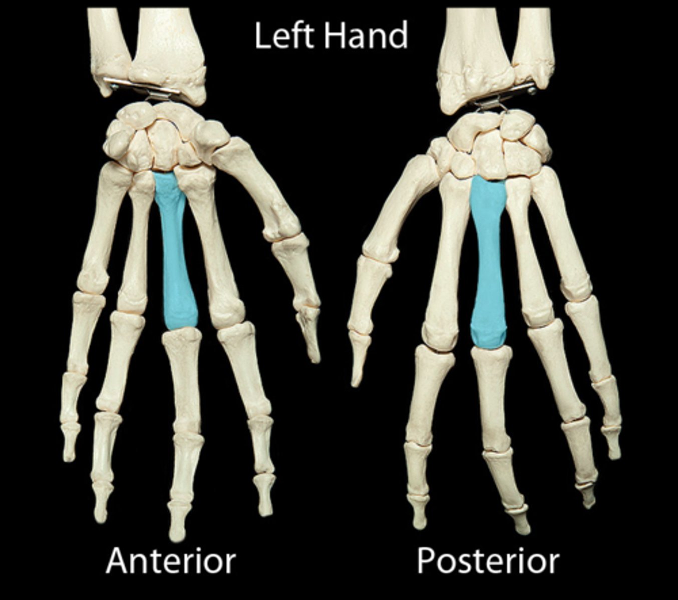 <p>What number is this metacarpal</p>