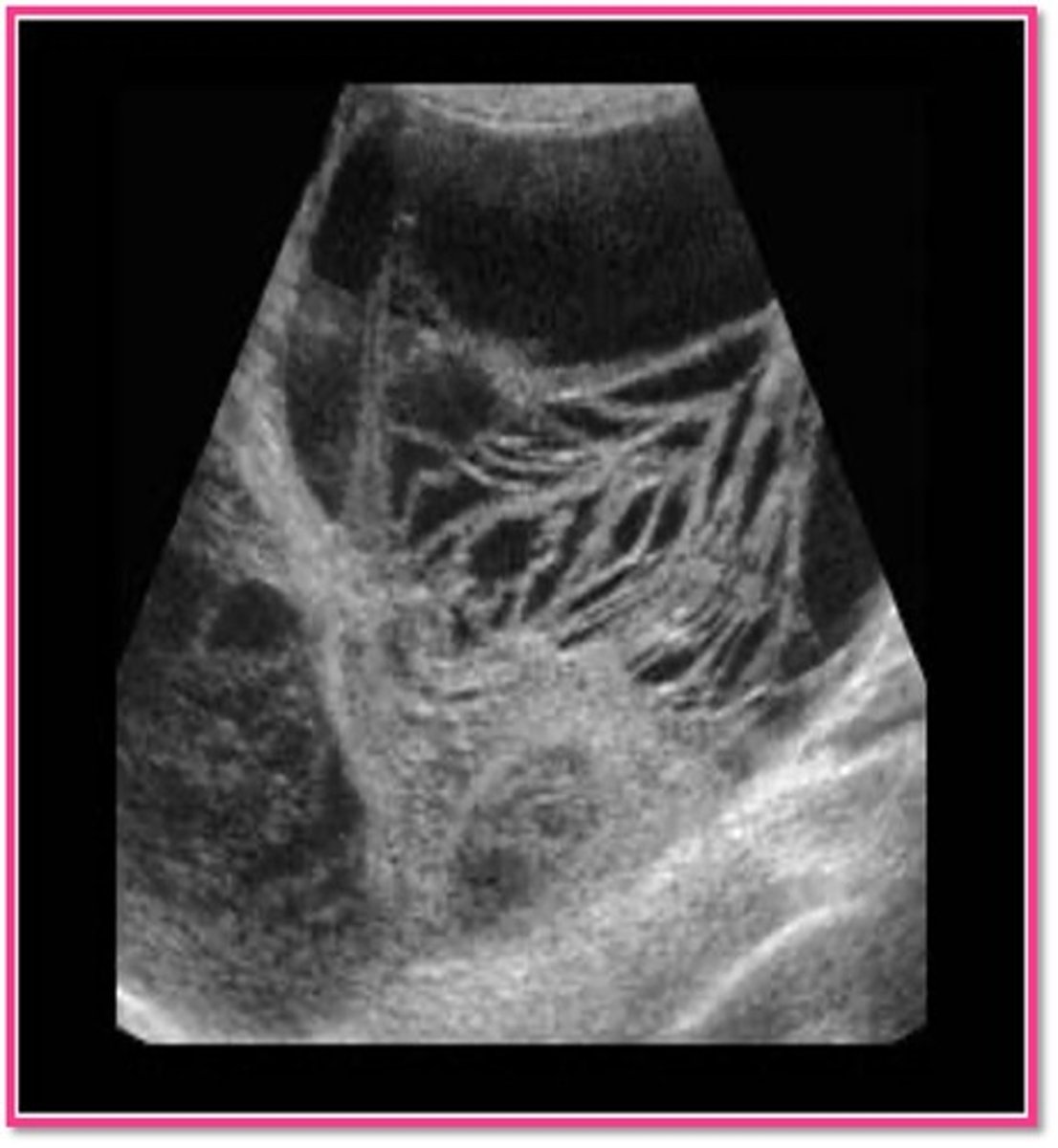 <p>bilateral</p>