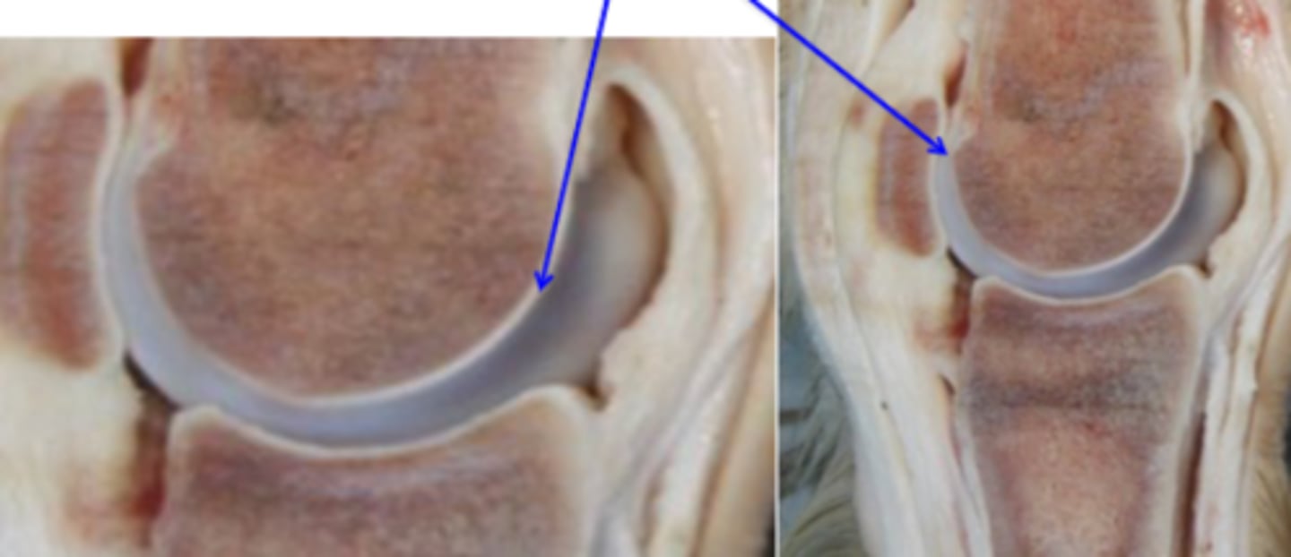 <p>Articular surfaces are clothed in _____, which is calcified in its deepest layer, which is firmly attached to the underlying cortex</p>