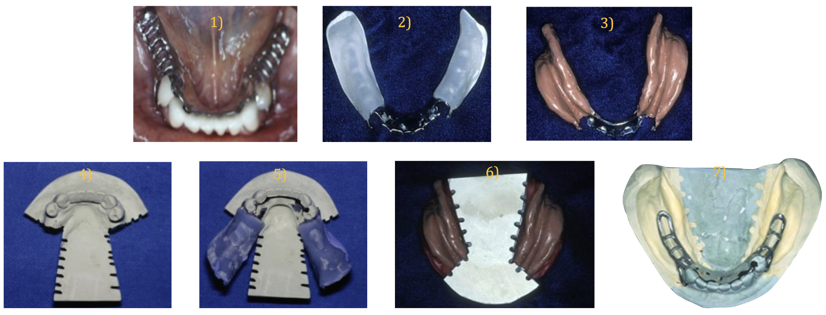 <p>which technique?</p>