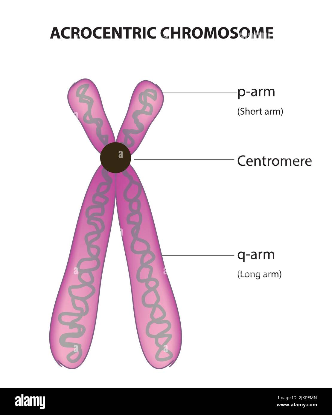 <p>Centromere is close to terminal end of chromosome </p>