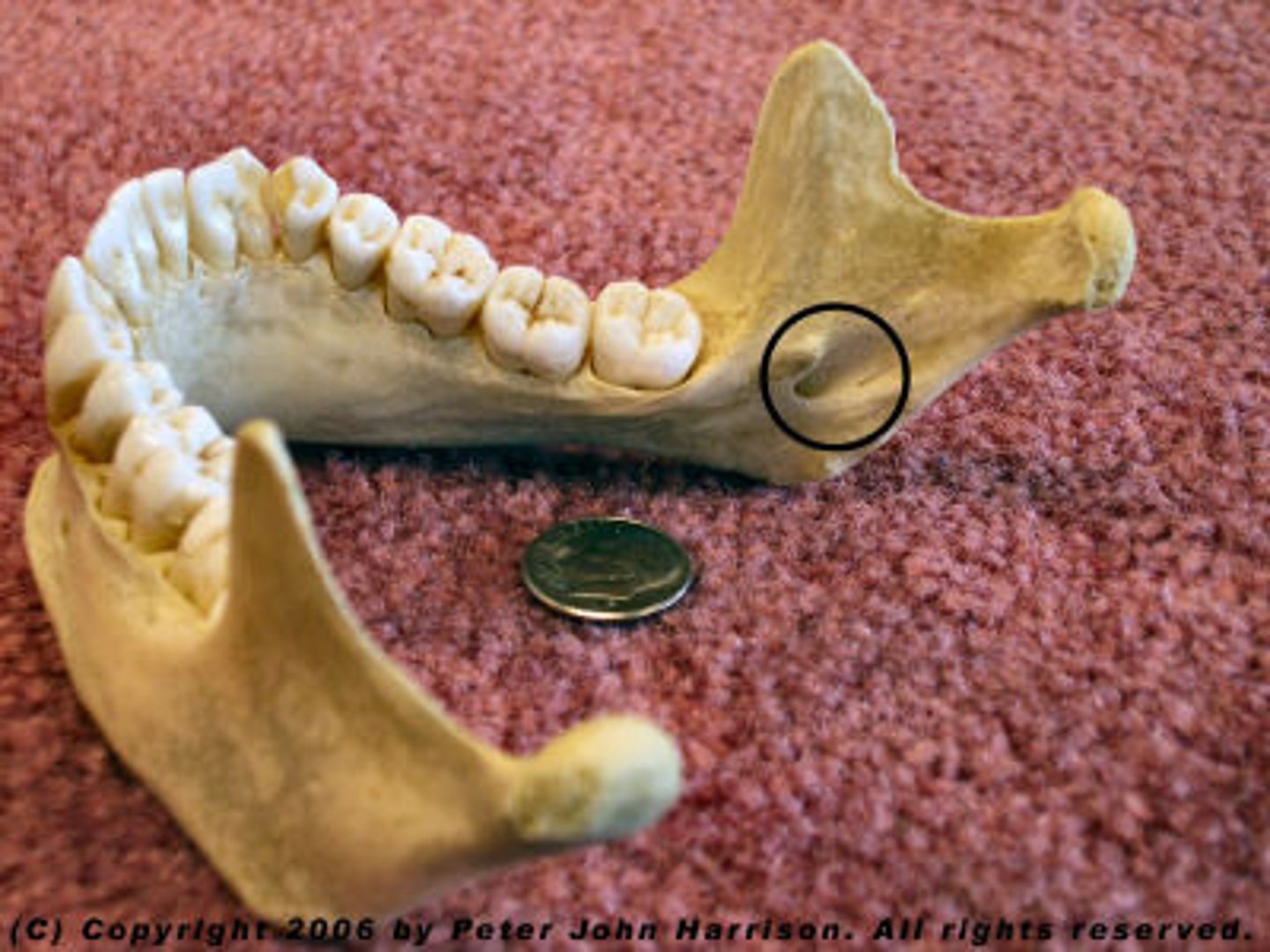 <p>on internal surface of ramus of jaw</p>