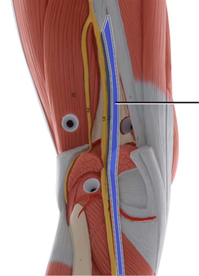 <p>Name this artery.</p>