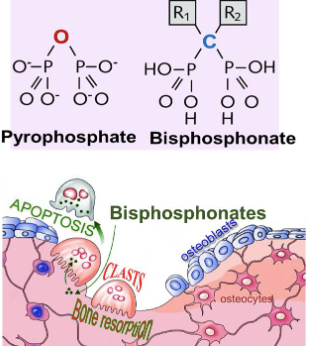 <ol><li><p>R1: OH group - binding to bone is enhanced</p></li><li><p>R2: Determines drug’s effects on binding to hydroxyapatite</p></li></ol><p></p>