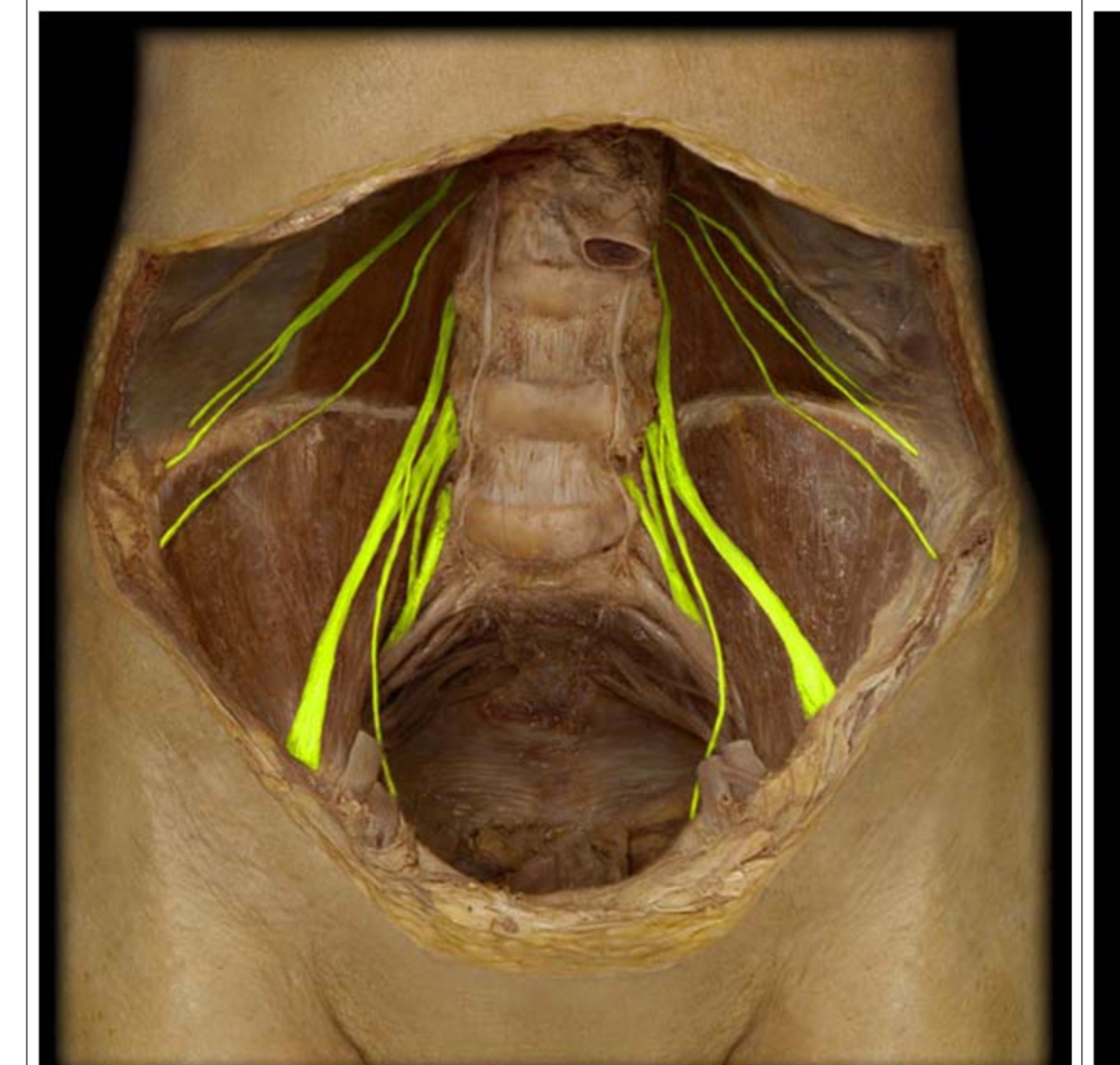 <p>What plexus is this</p>