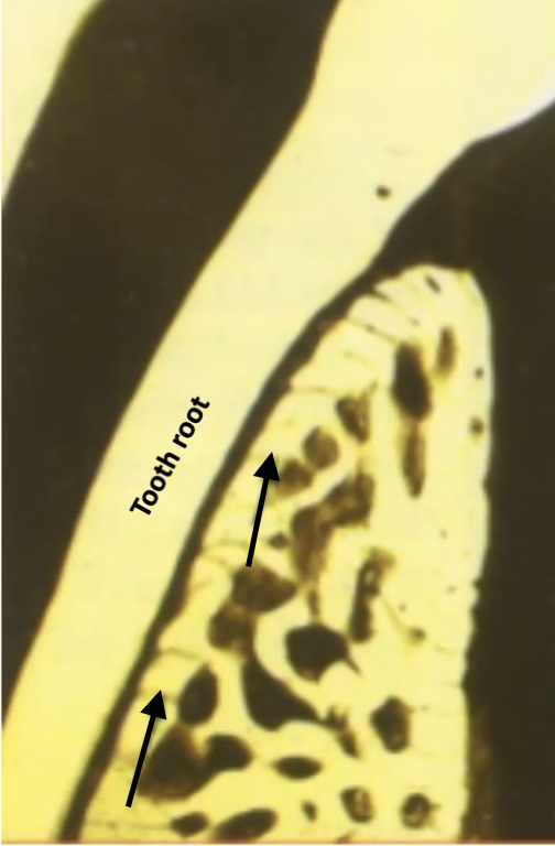 <p>what bone is indicated by the arrows </p>