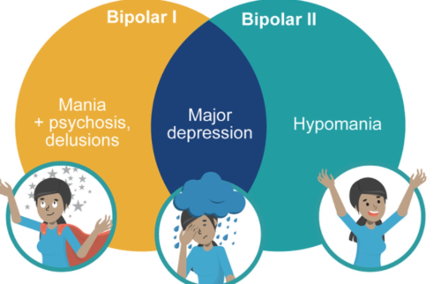 <p>Hypomania plus depressive episodes.</p>