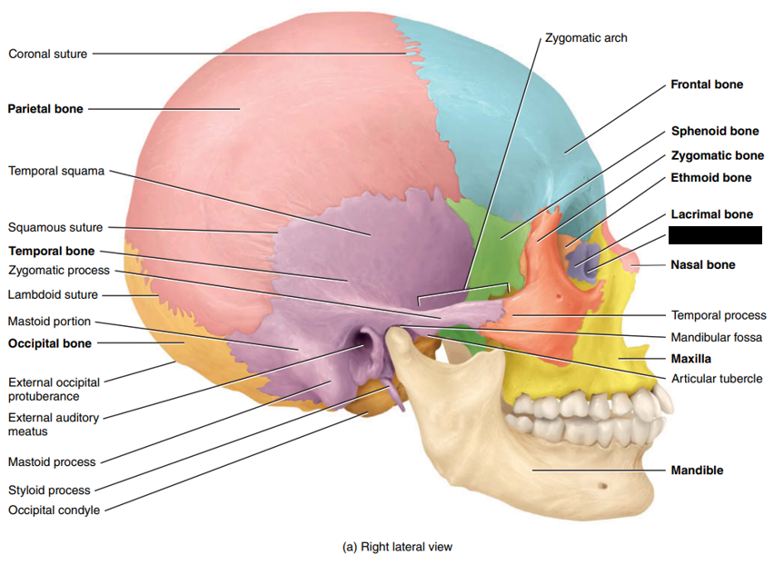 <p>State and identify what part of the cranial bone is being pointed out and censored. (hint: within the lacrimal bone or a type of fossa)</p>