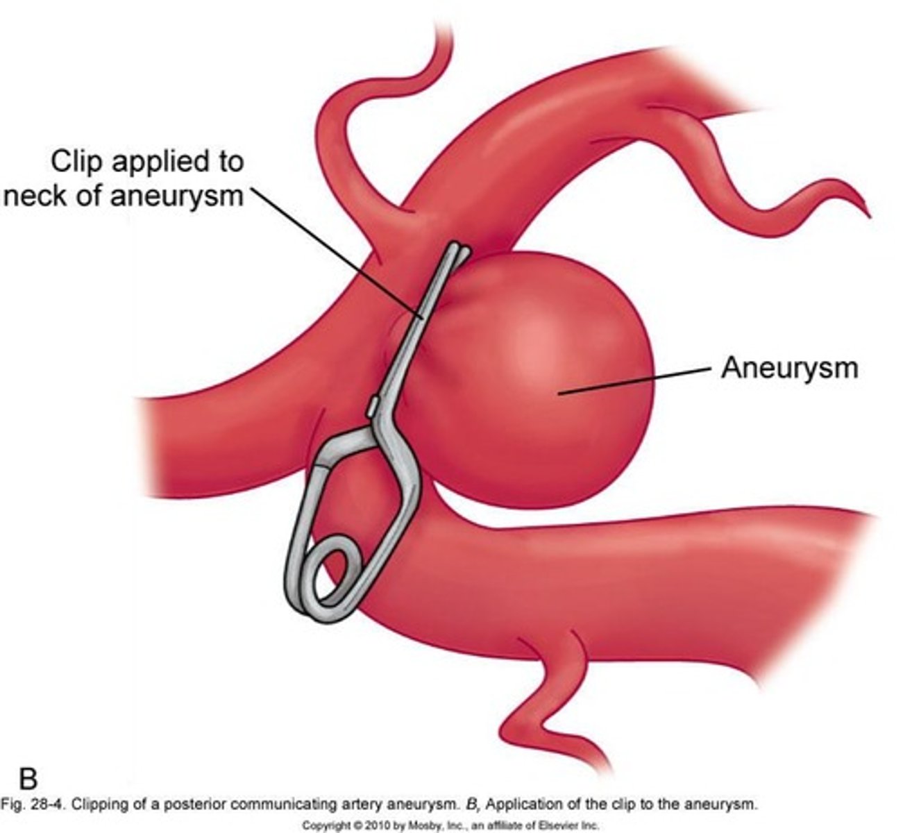 <p>Circular network allowing blood flow between hemispheres.</p>