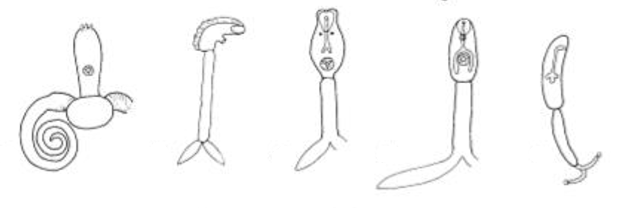 <p>Furcocercous Cercaria</p>