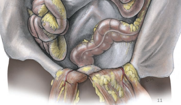 <p>attaches and suspends large intestine to posterior abdominal wall</p>
