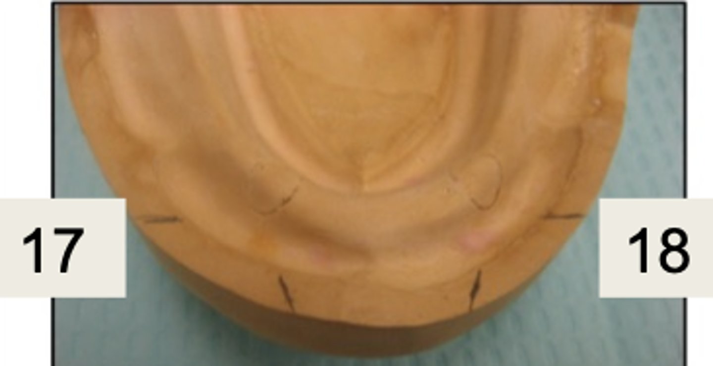 <p>What are 17 and 18?</p>