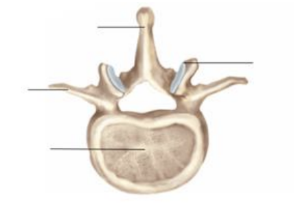 <p>what vertebrae type is this ?</p>