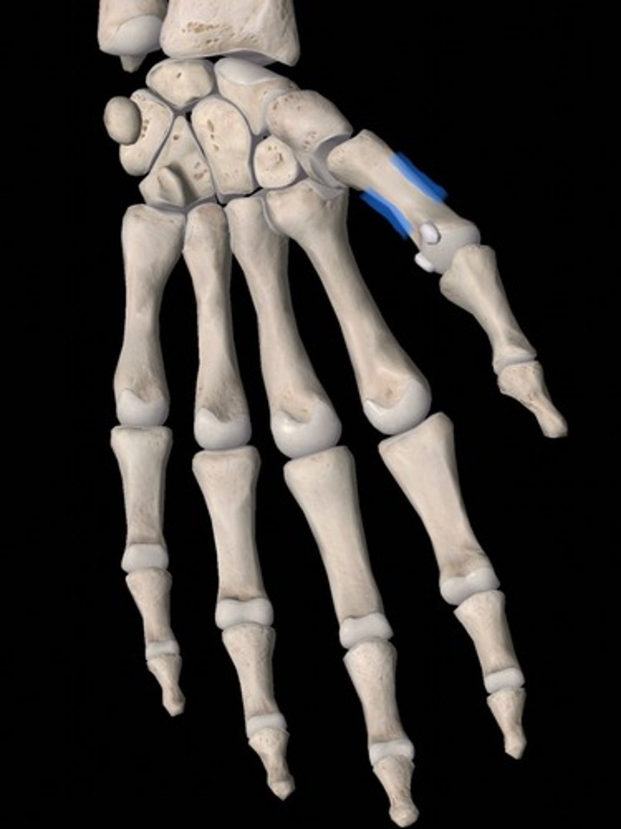 <p>bone</p>