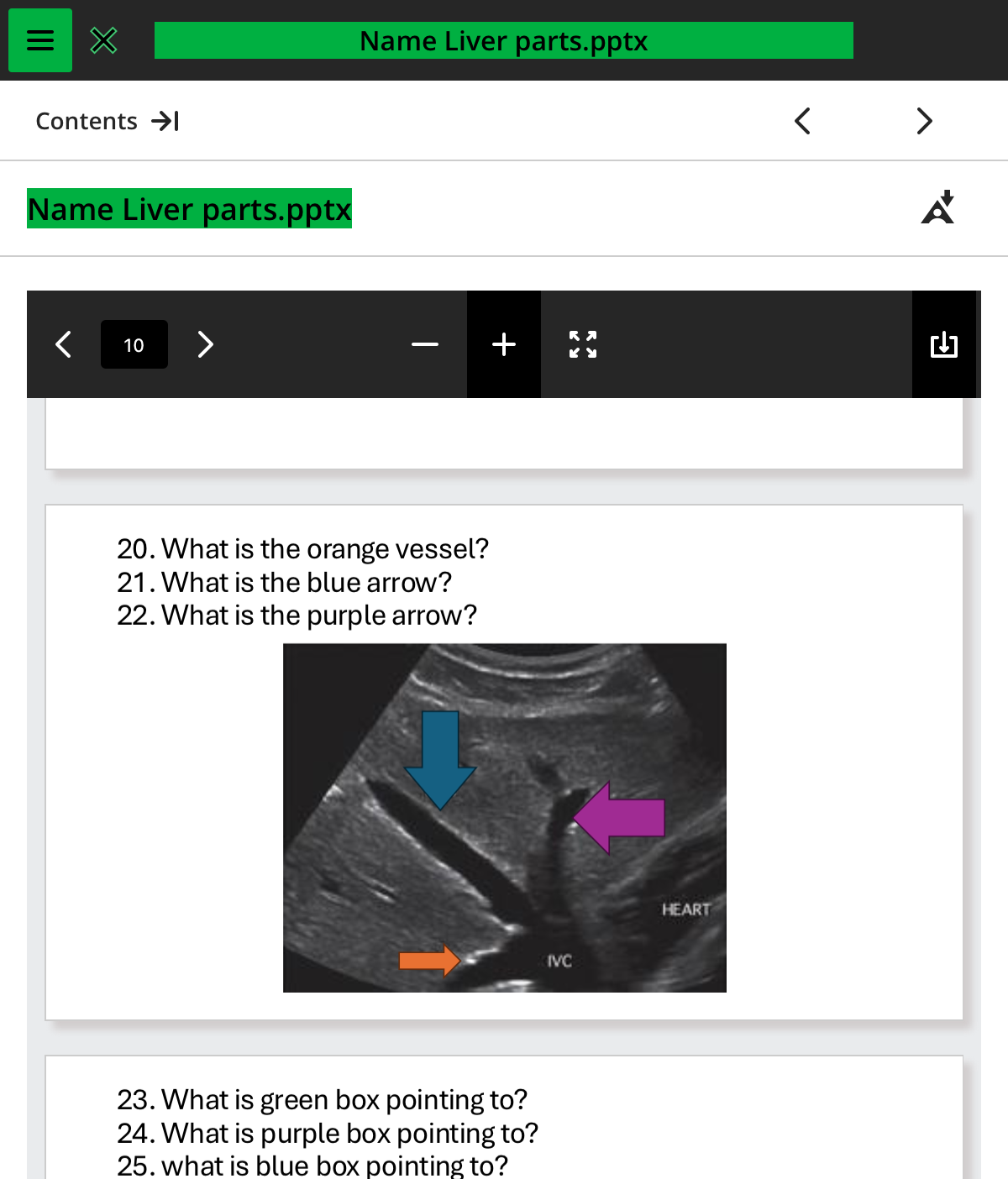<ol start="20"><li><p>what is the orange vessel</p></li></ol>