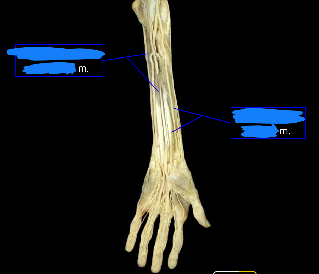 <p>left muscle</p>