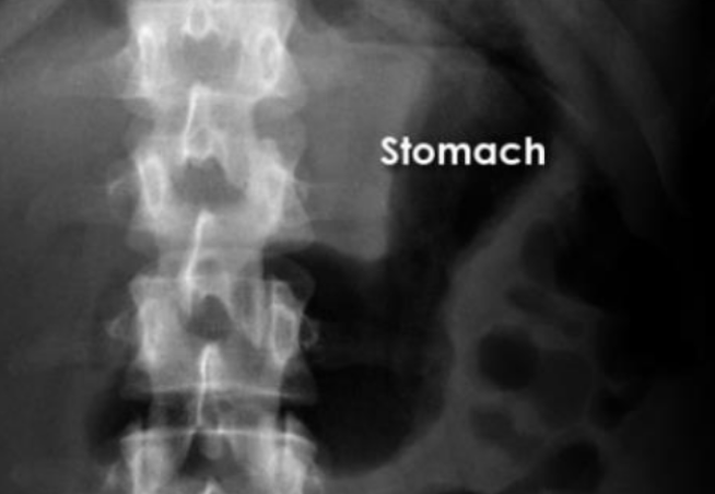 <p>What is this and what type of scan </p>