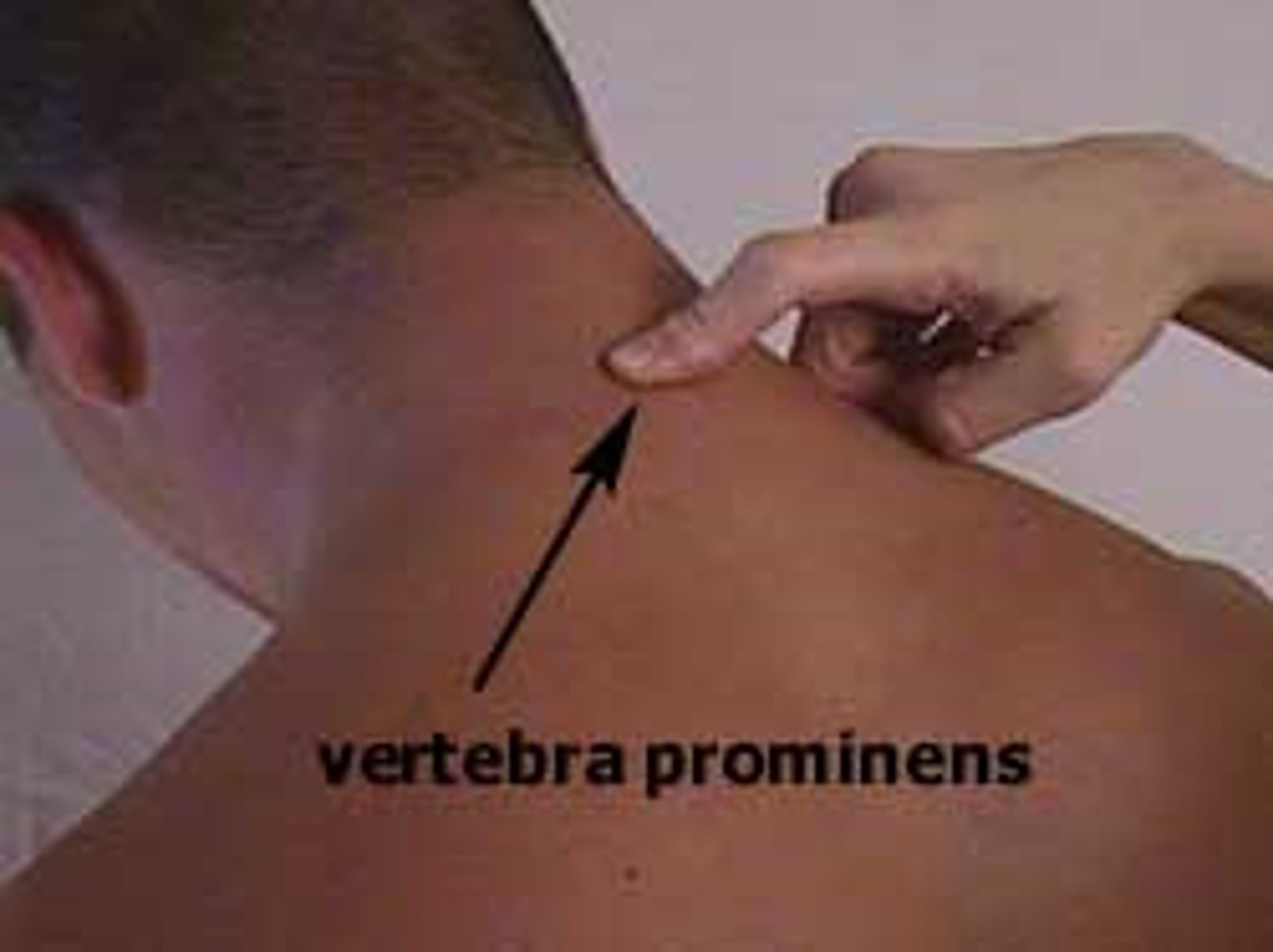 <p>the seventh vertical vertebra</p>