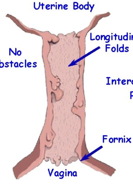 <p>What species does this cervix belong to?</p>